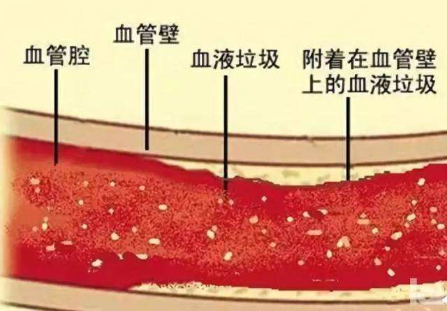 血管整体解说图